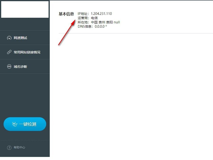 网络诊断流程